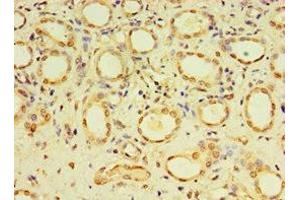 Immunohistochemistry of paraffin-embedded human kidney tissue using ABIN7149492 at dilution of 1:100 (DACT3 Antikörper  (AA 1-160))