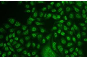 Immunofluorescence analysis of U2OS cells using TFPT Polyclonal Antibody (TFPT Antikörper)