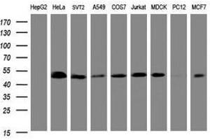 Image no. 2 for anti-SERPINE1 mRNA Binding Protein 1 (SERBP1) (AA 1-262) antibody (ABIN1490674)