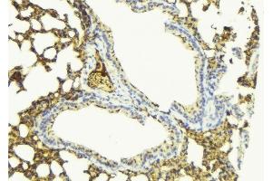 ABIN6276798 at 1/100 staining Mouse lung tissue by IHC-P. (PDE4D Antikörper  (C-Term))