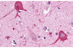 Immunohistochemical (Formalin/PFA-fixed paraffin-embedded sections) staining in human brain, neurons and glia with OPN3 polyclonal antibody . (OPN3 Antikörper  (C-Term))