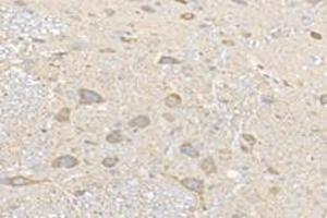 Immunohistochemistry (Paraffin-embedded Sections) (IHC (p)) image for anti-NCK Associated Protein 1 (NCKAP1) antibody (ABIN7074784)