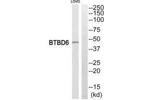 Western blot analysis of extracts from LOVO cells, using BTBD6 antiobdy. (BTBD6 Antikörper)