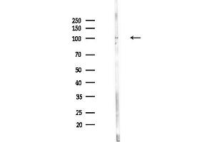 anti-Disrupted in Schizophrenia 1 (DISC1) (N-Term) antibody
