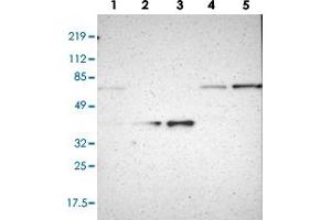 Western blot analysis of Lane 1: RT-4, Lane 2: U-251 MG, Lane 3: A-431, Lane 4: Liver, Lane 5: Tonsil with NCF2 polyclonal antibody (PAB28551). (NCF2 Antikörper)