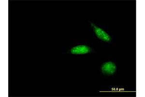 Immunofluorescence of purified MaxPab antibody to ZNF447 on HeLa cell.