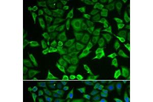 Immunofluorescence analysis of MCF-7 cells using RARS Polyclonal Antibody (RARS Antikörper)