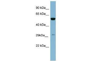 KLK10 antibody used at 1 ug/ml to detect target protein.