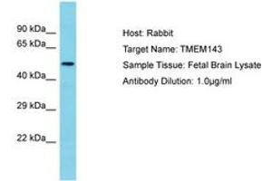 Image no. 1 for anti-Transmembrane Protein 143 (TMEM143) (AA 39-88) antibody (ABIN6750625) (TMEM143 Antikörper  (AA 39-88))