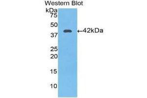 Western Blotting (WB) image for anti-Transferrin (TF) (AA 361-683) antibody (ABIN3201672) (Transferrin Antikörper  (AA 361-683))