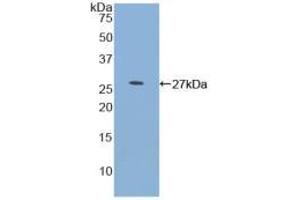 Western blot analysis of recombinant Human MYOC. (MYOC Antikörper  (AA 224-471))