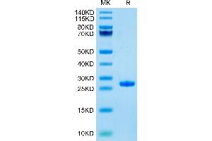 Human Complement Factor D on Tris-Bis PAGE under reduced condition. (Adipsin Protein (AA 26-253) (His tag))