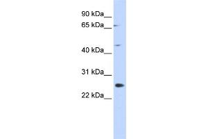 SPATA22 Antikörper  (N-Term)