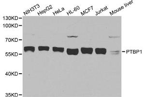 Western blot analysis of extracts of various cell lines, using PTBP1 antibody. (PTBP1 Antikörper)