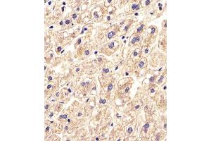 Antibody staining SLC16A11 in Human liver tissue sections by Immunohistochemistry (IHC-P - paraformaldehyde-fixed, paraffin-embedded sections).