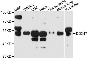 Western blot analysis of extracts of various cell lines, using DDX47 antibody. (DDX47 Antikörper)