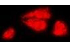 Immunofluorescent analysis of DAX1 staining in MCF7 cells.
