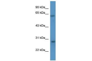 WB Suggested Anti-Cish Antibody Titration: 0. (CISH Antikörper  (N-Term))