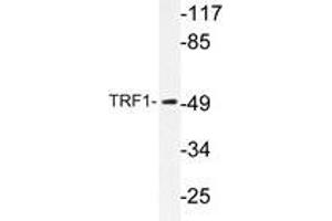 Western blot analysis of TRF1 antibody in extracts from 293 cells. (TRF1 Antikörper)