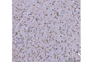 IHC analysis of BBS9 using anti-BBS9 antibody (ABIN7601518). (BBS9 Antikörper  (AA 37-793))