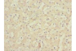 Immunohistochemistry of paraffin-embedded human liver tissue using ABIN7147123 at dilution of 1:100