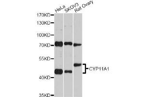 Western blot analysis of extracts of various cell lines, using CYP11A1 Antibody (ABIN5970856) at 1/2000 dilution. (CYP11A1 Antikörper)