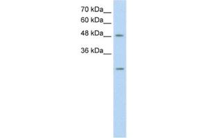 Western Blotting (WB) image for anti-Ankyrin Repeat Domain 2 (Stretch Responsive Muscle) (ANKRD2) antibody (ABIN2462604) (ANKRD2 Antikörper)