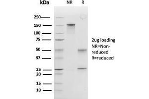 SDS-PAGE Analysis Purified Peroxiredoxin 4 Monoclonal Antibody (CPTC-PRDX4-2). (Peroxiredoxin 4 Antikörper)