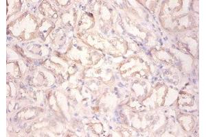 Immunohistochemistry of paraffin-embedded human kidney tissue using ABIN7154210 at dilution of 1:100 (PYGL Antikörper  (AA 2-846))