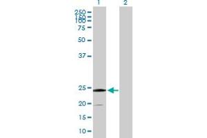 Western Blot analysis of SSR2 expression in transfected 293T cell line by SSR2 MaxPab polyclonal antibody. (SSR2 Antikörper  (AA 1-186))