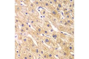 Immunohistochemistry of paraffin-embedded human liver injury using RPS7 antibody at dilution of 1:100 (x40 lens). (RPS7 Antikörper)