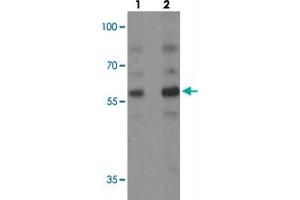 Western blot analysis of PLAGL2 in rat brain tissue with PLAGL2 polyclonal antibody  at (1) 1 and (2) 2 ug/mL.