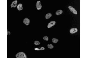 Immunofluorescent staining of HeLa (ATCC CCL-2) cells. (PSME3 Antikörper  (AA 45-147))