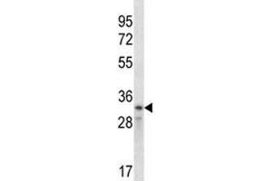 Cyclin D2 antibody western blot analysis in CEM lysate (Cyclin D2 Antikörper  (AA 1-30))