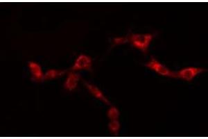ABIN6276441 staining  SKOV3 cells by IF/ICC. (GRP94 Antikörper  (C-Term))