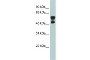 Image no. 1 for anti-Platelet-Activating Factor Acetylhydrolase 1b, Regulatory Subunit 1 (45kDa) (PAFAH1B1) (AA 71-120) antibody (ABIN6743973) (PAFAH1B1 Antikörper  (AA 71-120))