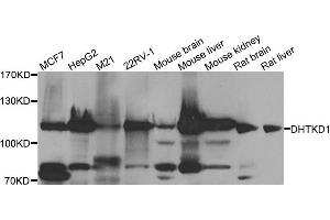 Western blot analysis of extracts of various cell lines, using DHTKD1 antibody. (DHTKD1 Antikörper)