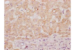 IHC image of ABIN7155014 diluted at 1:100 and staining in paraffin-embedded human liver tissue performed on a Leica BondTM system. (HS3ST3B1 Antikörper  (AA 54-390))