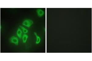 Immunofluorescence analysis of HepG2 cells, using TNFA Antibody. (TNF alpha Antikörper  (AA 141-190))