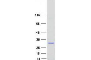 Western Blotting (WB) image for GTPase Kras (KRAS) (Transcript Variant A) protein (Myc-DYKDDDDK Tag) (ABIN2724422)