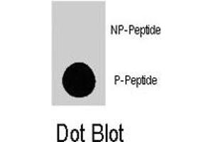 Dot blot analysis of TSC2 (phospho S1798) polyclonal antibody  on nitrocellulose membrane.