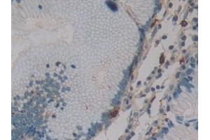 Immunohistochemistry (IHC) image for anti-Dynamin 2 (DNM2) (AA 533-731) antibody (ABIN7433204)