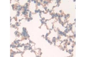 Used in DAB staining on fromalin fixed paraffin- embedded Kidney tissue (CD97 Antikörper  (AA 191-304))
