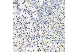 Immunohistochemistry of paraffin-embedded human appendicitis using SUMO4 Antibody. (SUMO4 Antikörper)