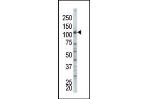 Image no. 1 for anti-Hexokinase 2 (HK2) (AA 409-438), (Middle Region) antibody (ABIN360641)