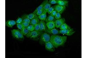IF analysis of NSE using anti-NSE antibody (ABIN6719549). (ENO2/NSE Antikörper)