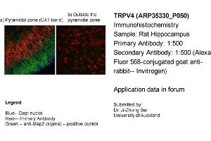 Immunohistochemistry (IHC) image for anti-Transient Receptor Potential Cation Channel, Subfamily V, Member 4 (TRPV4) (Middle Region) antibody (ABIN2776240) (TRPV4 Antikörper  (Middle Region))