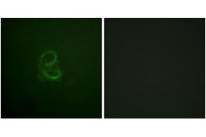 Immunofluorescence analysis of A549 cells, using IL-4R/CD124 (Ab-497) Antibody. (IL4 Receptor Antikörper  (AA 463-512))