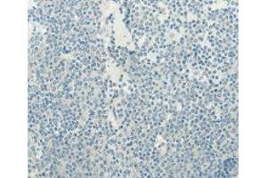 Immunohistochemistry (IHC) image for anti-Telomerase Reverse Transcriptase (TERT) antibody (ABIN1875058) (TERT Antikörper)