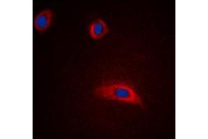 Immunofluorescent analysis of GAP43 staining in HeLa cells. (GAP43 Antikörper  (N-Term))